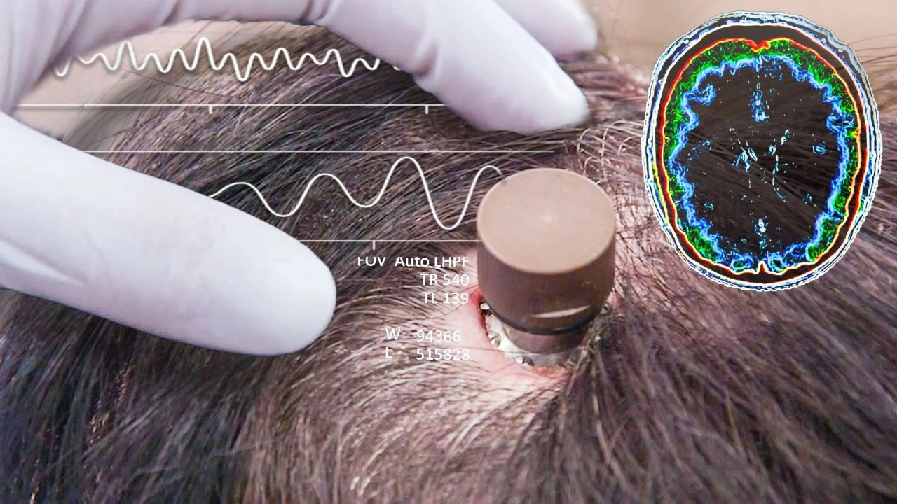 Thế Giới Số 365 | Chip Não Giúp Tự Dựng Video và Đăng YouTube Bằng Suy Nghĩ!